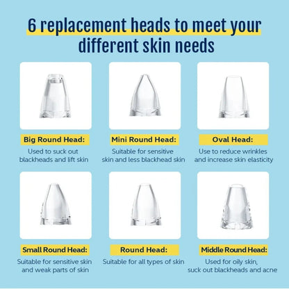 Rechargeable Blackhead Remover Vacuum – Pore Cleaner & Acne Extraction Tool